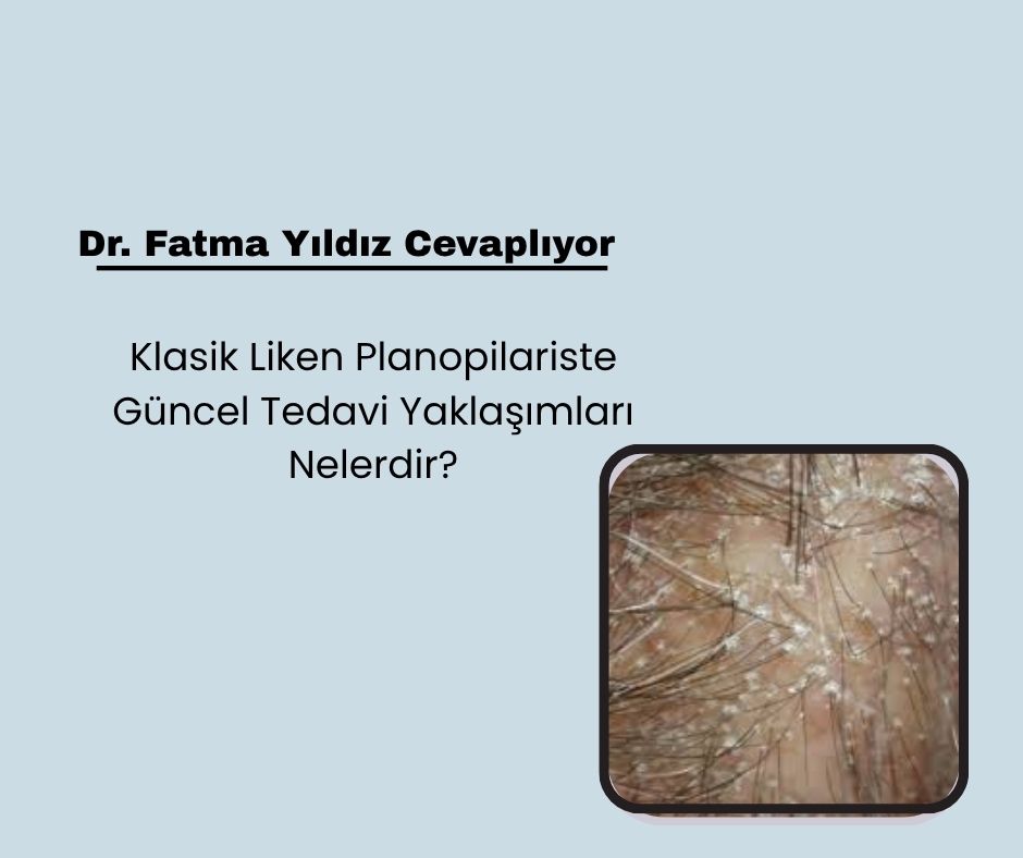 Klasik Liken Planopilariste Güncel Tedavi Yaklaşımları Nelerdir?