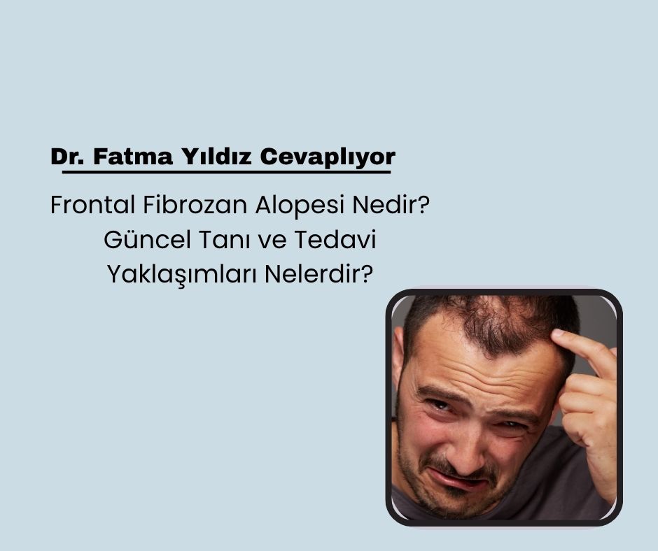 Frontal Fibrozan Alopesi Nedir? Güncel Tanı ve Tedavi Yaklaşımları Nelerdir?