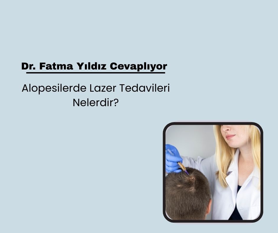 Alopesilerde Lazer Tedavileri Nelerdir?