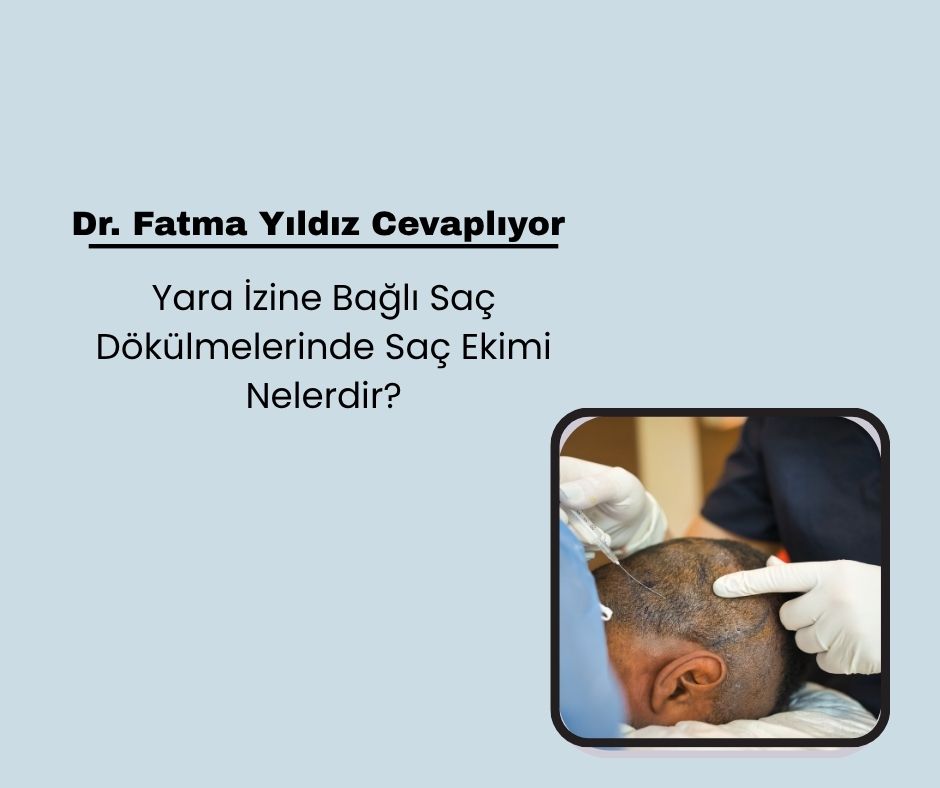 Yara İzine Bağlı Saç Dökülmelerinde Saç Ekimi Nelerdir?