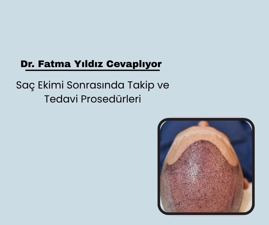 Saç Ekimi Sonrasında Takip ve Tedavi Prosedürleri