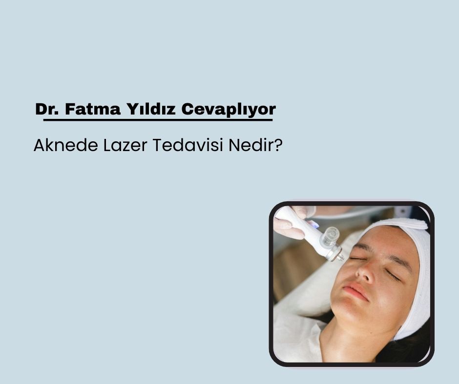 Aknede Lazer Tedavisi Nedir?