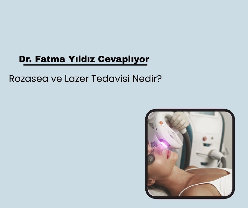 Rozasea ve Lazer Tedavisi Nedir?