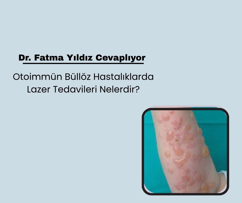 Otoimmün Büllöz Hastalıklarda Lazer Tedavileri Nelerdir?
