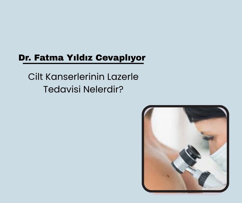Cilt Kanserlerinin Lazerle Tedavisi Nelerdir?