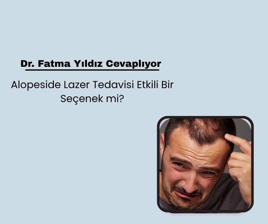 Alopeside Lazer Tedavisi Etkili Bir Seçenek mi?
