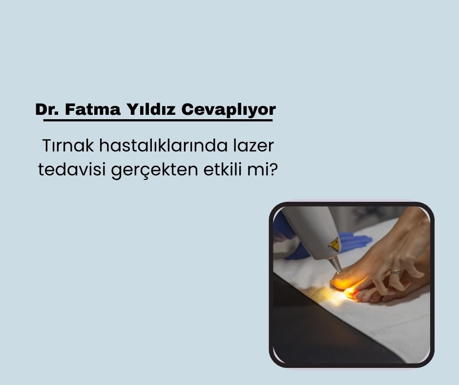 Tırnak hastalıklarında lazer tedavisi gerçekten etkili mi?
