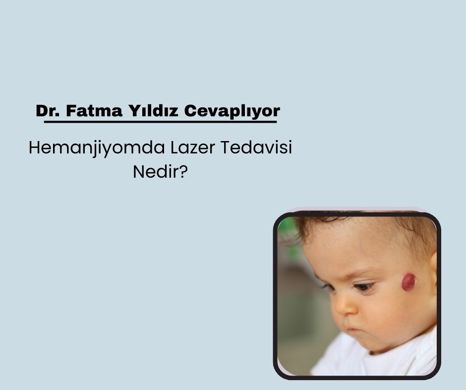 Hemanjiyomda Lazer Tedavisi Nedir?