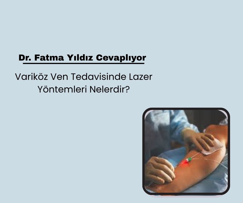 Variköz Ven Tedavisinde Lazer Yöntemleri Nelerdir?