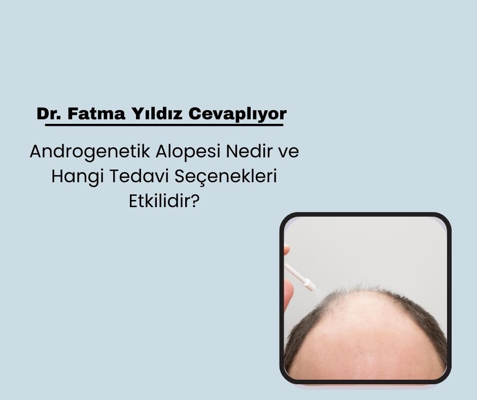 Androgenetik Alopesi Nedir ve Hangi Tedavi Seçenekleri Etkilidir?