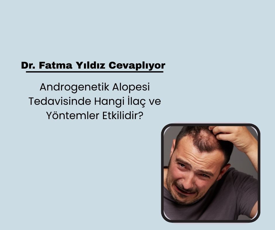 Androgenetik Alopesi Tedavisinde Hangi İlaç ve Yöntemler Etkilidir?