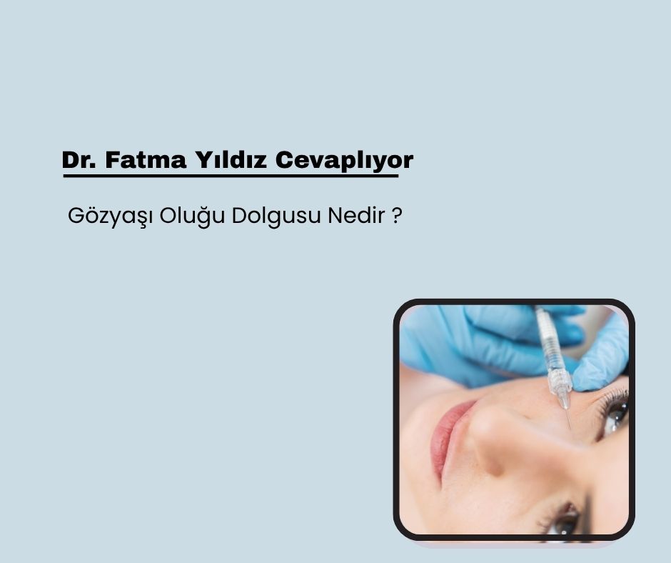 Gözyaşı Oluğu Dolgusu Nedir ?