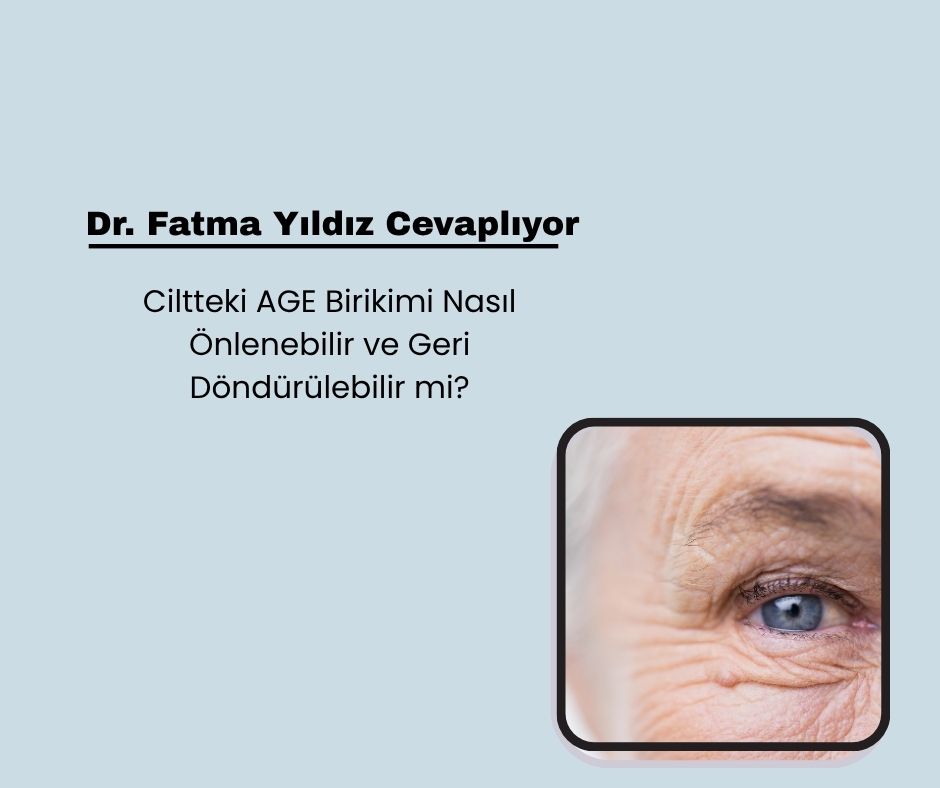 Ciltteki AGE Birikimi Nasıl Önlenebilir ve Geri Döndürülebilir mi?