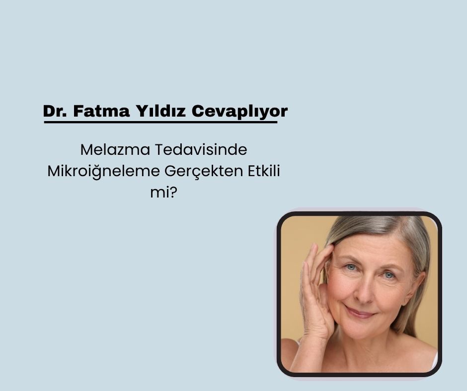 Melazma Tedavisinde Mikroiğneleme Gerçekten Etkili mi?