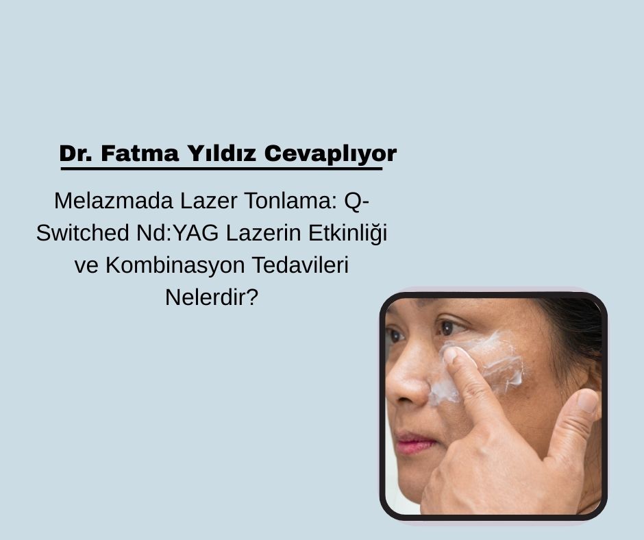 Melazmada Lazer Tonlama: Q-Switched Nd:YAG Lazerin Etkinliği ve Kombinasyon Tedavileri Nelerdir?