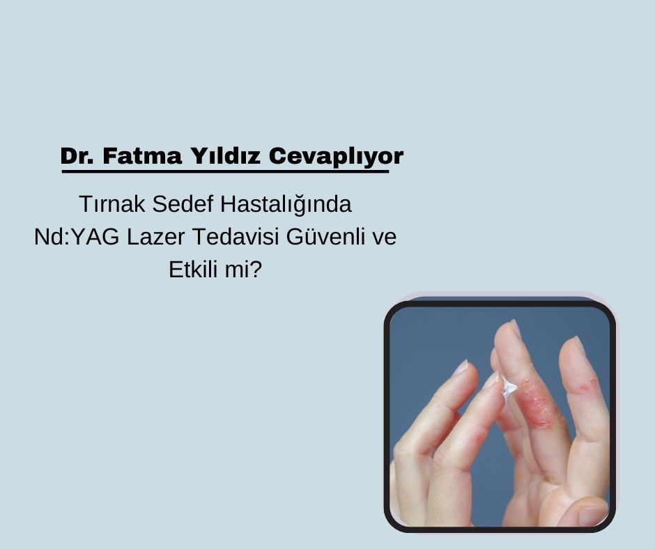 Tırnak Sedef Hastalığında Nd:YAG Lazer Tedavisi Güvenli ve Etkili mi?